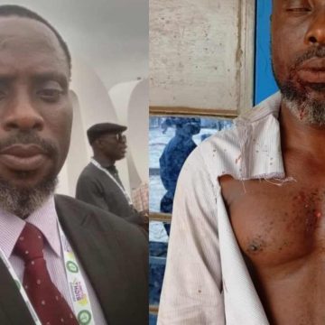 ‘MY ORDEAL IN THE HANDS OF PALACE THUGS IN AKURE,’ BY LAWYER